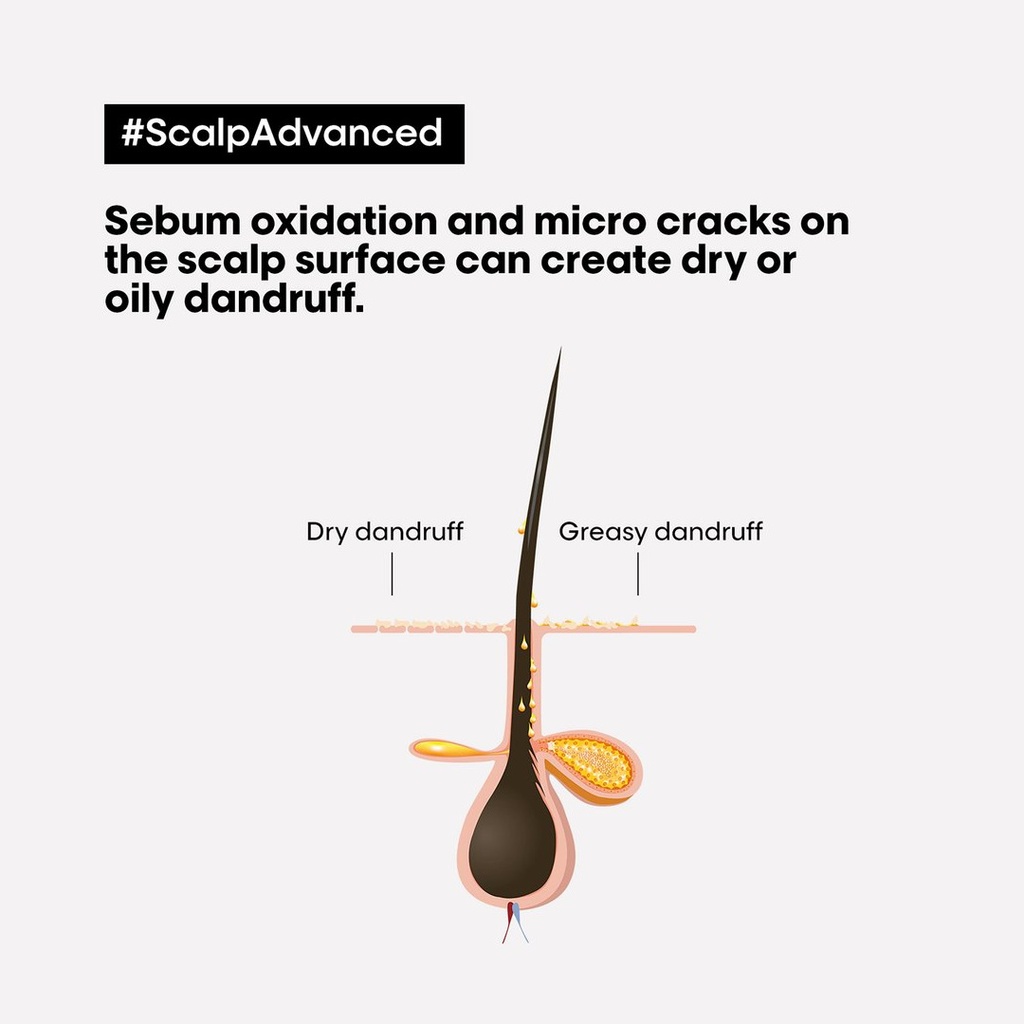 Scalp Advanced - Anti-Dandruff Shampoo