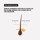 Scalp Advanced - Anti-Dandruff Shampoo