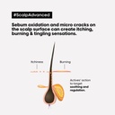 Scalp Advanced - Intense Soother Conditioner